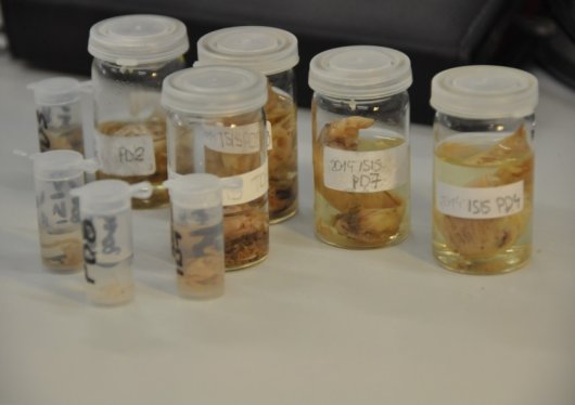 Stomach contents of plaice